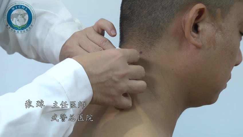 套针治疗颈椎病 — 张琼教授（世中联套针专委会高峰论坛）